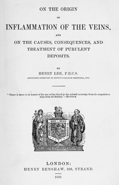 On the origin of inflammation of the veins / and of the causes, consequences, and treatment of purulent deposits cover