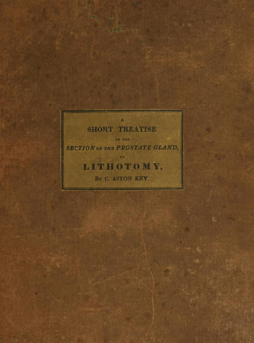 A Short Treatise on the Section of the Prostate Gland in Lithotomy / With an Explanation of a Safe and Easy Method of Conducting the Operation on the Principles of Cheselden cover